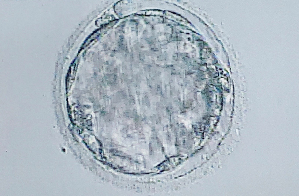 3AA embryo